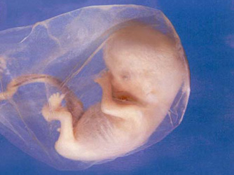 8weeks-fetus.jpg